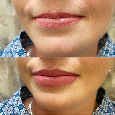 Перманентный макияж губ, фото 17, январь 2021